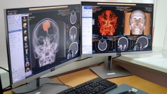 В БСМП Новочеркасска возобновил работу компьютерный томограф
