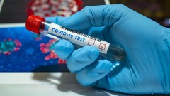 В Новочеркасске за прошедшие сутки выявили 3 новых случая заболевания коронавирусом