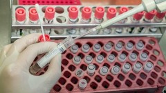 В Ростовской области за прошедшие сутки зарегистрировано 127 случаев заболевания коронавирусом, еще 6 человек умерли