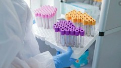 В Ростовской области за прошедшие сутки зарегистрировано 269 случаев заболевания коронавирусом, еще 10 человек умерли