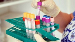 В Новочеркасске за прошедшие сутки 12 человек заразились коронавирусом
