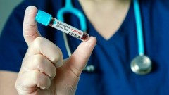 В Новочеркасске за прошедшие сутки 4 человека заразились коронавирусом