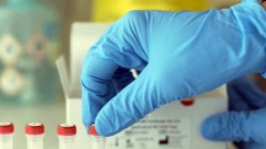 В Новочеркасске за прошедшие сутки 4 человека заразились коронавирусом