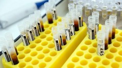 В Ростовской области за прошедшие сутки зарегистрировано 124 случая заболевания коронавирусом, еще 2 человека умерли