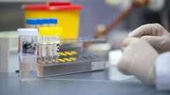В Ростовской области за прошедшие сутки зарегистрировано более 100 случаев заболевания коронавирусом