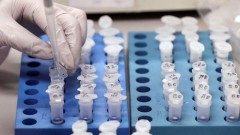 В Ростовской области за сутки зарегистрировали 80 случаев заболевания коронавирусом, еще 3 человека умерли