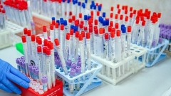 Общее количество заразившихся коронавирусом в Ростовской области превысило 12 тысяч человек
