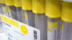 В Ростовской области за прошедшие сутки зарегистрировано 136 случаев заболевания коронавирусом, еще 5 человек умерли
