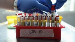 В Ростовской области за прошедшие сутки зарегистрировано 193 случая заболевания коронавирусом