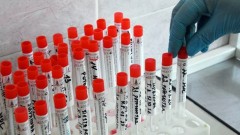 В Ростовской области общее количество заразившихся коронавирусом превысило 17 тысяч человек