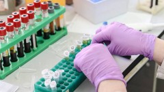 В Ростовской области за прошедшие сутки зарегистрировано 198 случаев заболевания коронавирусом, еще 9 человек умерли