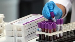 В Новочеркасске за прошедшие сутки 14 человек заразились коронавирусом