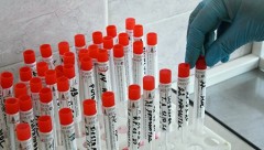 В Ростовской области за прошедшие сутки зарегистрировано 285 случаев заболевания коронавирусом, еще 7 человек умерли