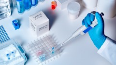 В Ростовской области за сутки зарегистрировали 81 случай заболевания коронавирусом, еще 1 человек умер