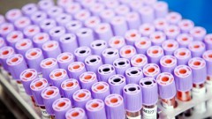 В Ростовской области за прошедшие сутки зарегистрировано 92 случая заболевания коронавирусом, еще 4 человека умерли