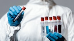 В Новочеркасске за прошедшие сутки 9 человек заразились коронавирусом