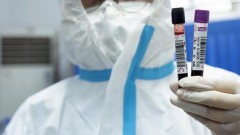 В Новочеркасске за прошедшие сутки 2 человека заразились коронавирусом