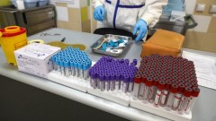 Общее количество заразившихся коронавирусом в Ростовской области превысило 20 тысяч человек
