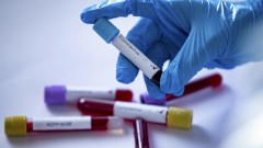 В Новочеркасске за прошедшие сутки 6 человек заразились коронавирусом
