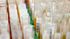 В Ростовской области за прошедшие сутки зарегистрировано 129 случаев заболевания коронавирусом, еще 5 человек умерли