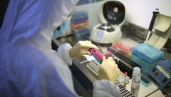 В Ростовской области выявили еще 4 новых случая заболевания коронавирусом