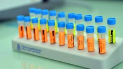 В Новочеркасске за прошедшие сутки 19 человек заразились коронавирусом