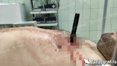 В Новочеркасске хирурги спасли жизнь заключенному, которого ударили ножом в сердце