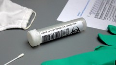 В Новочеркасске за прошедшие сутки 1 человек заразился коронавирусом