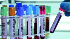 В Новочеркасске общее количество заболевших COVID-19 превысило 900 человек