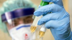 В Новочеркасске за прошедшие сутки 2 человека заразились коронавирусом