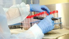 В Ростовской области за прошедшие сутки зарегистрировано 219 случаев заболевания коронавирусом, еще 9 человек умерли