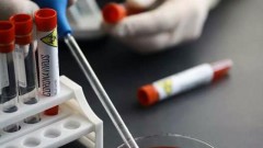 В Новочеркасске за прошедшие сутки 3 человека заразились коронавирусом