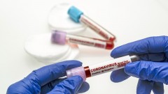 В Новочеркасске за прошедшие сутки 3 человека заразились коронавирусом