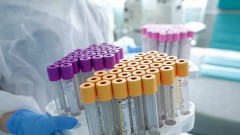 В Ростовской области за прошедшие сутки зарегистрировано 139 случаев заболевания коронавирусом, еще 4 человека умерли