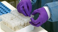 В Ростовской области за прошедшие сутки зарегистрировано 253 случая заболевания коронавирусом, еще 10 человек умерли