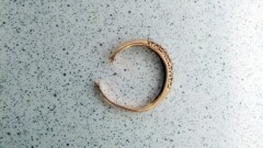 В Новочеркасске спасатели помогли женщине снять кольцо с опухшего пальца