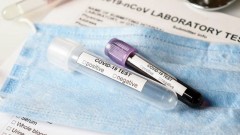 В Новочеркасске за прошедшие сутки 2 человека заразились коронавирусом