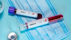 В Новочеркасске за прошедшие сутки выявили 2 новых случая заболевания коронавирусом