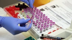 В Ростовской области за прошедшие сутки зарегистрировано 280 случаев заболевания коронавирусом, еще 9 человек умерли