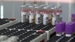 В Ростовской области общее количество заразившихся коронавирусом превысило 13 тысяч человек
