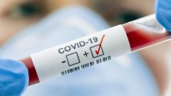 В Ростовской области выявили 3 новых случая заболевания коронавирусом