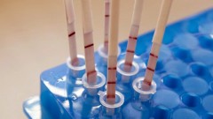 В Новочеркасске за прошедшие сутки 6 человек заразились коронавирусом
