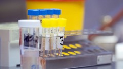В Новочеркасске за прошедшие сутки 7 человек заразились коронавирусом