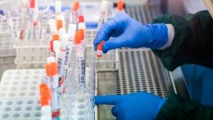 В Ростовской области за прошедшие сутки зарегистрировано 128 случаев заболевания коронавирусом, еще 3 человека умерли